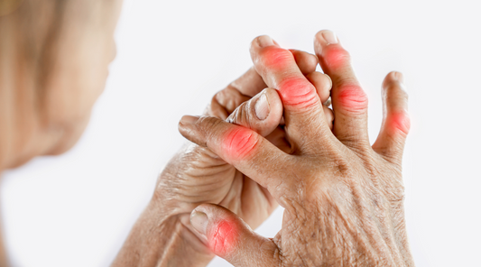 Relieve Gout, Joint Pain, and Arthritis with Jenny's Tablets